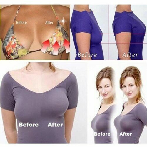 Invisible Breast Lift Tape 5M Roll Push-up Boob Shape Bra Nipple Cover Sticker
