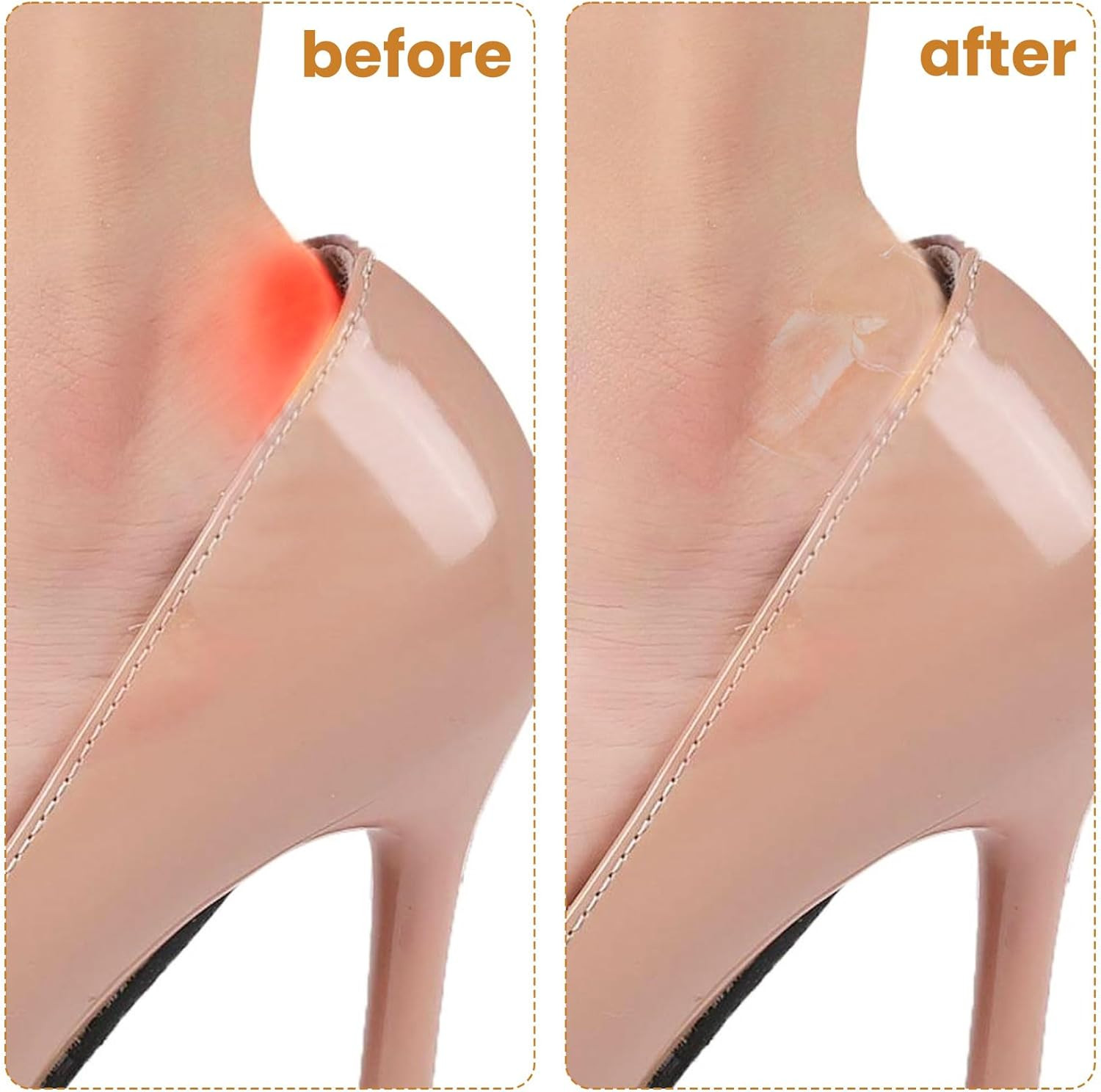 40Pcs Invisible Heel Anti-Wear Stickers, Self-Adhesive Heel Protectors Pad, Tran