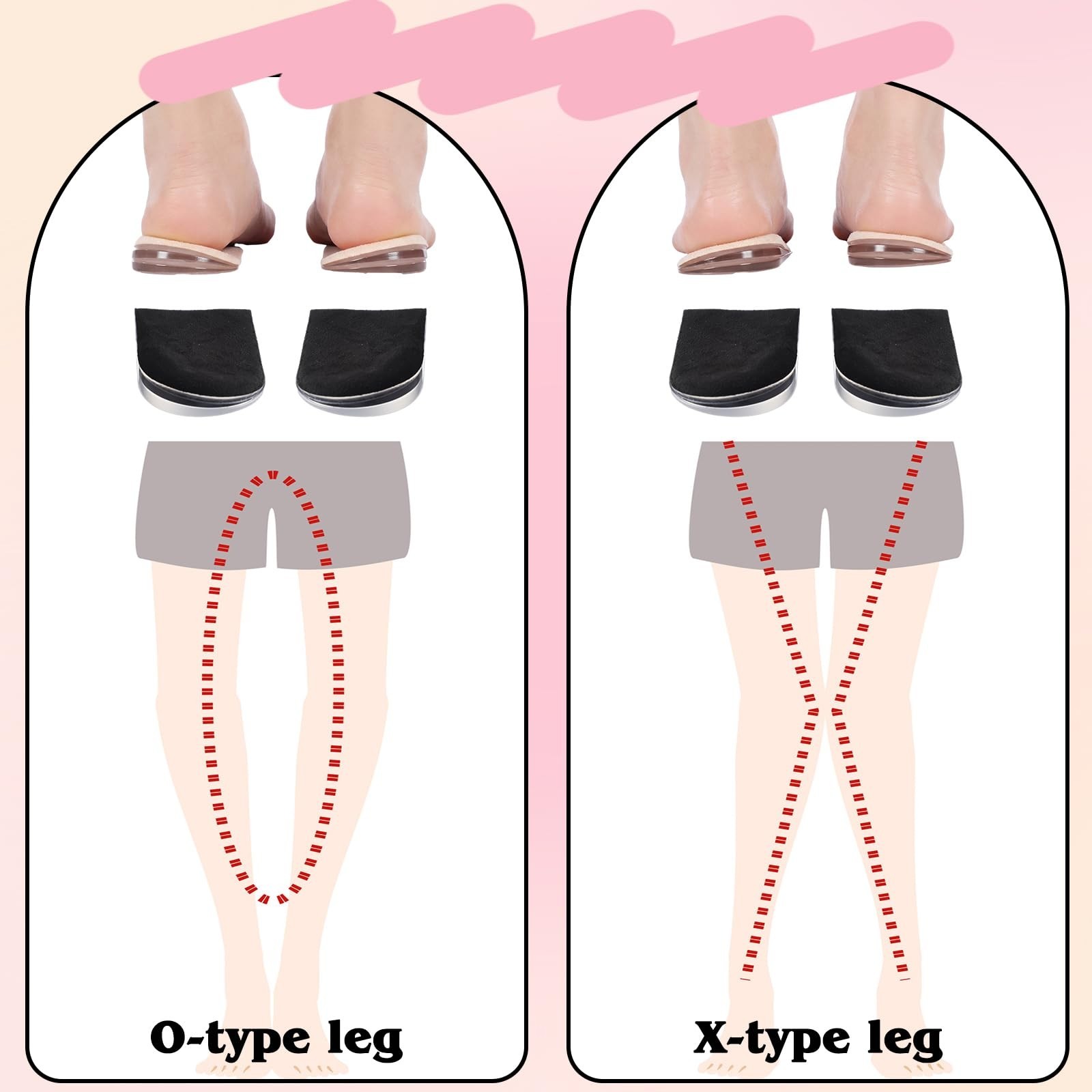 4 Pairs Adjustable Heel Wedge Insoles for Supination Overpronation Pain Relief