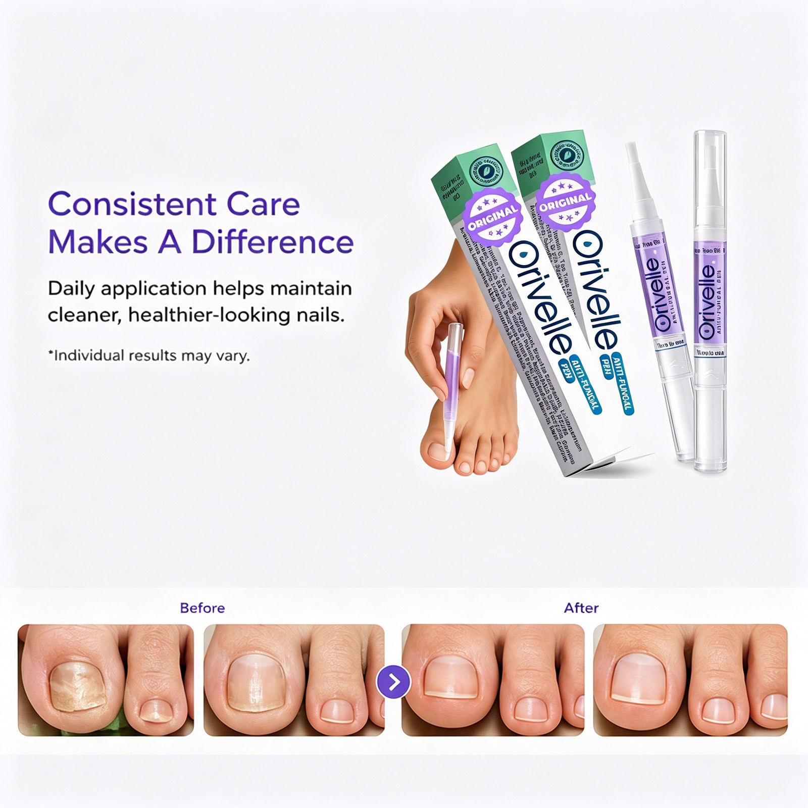 1/2/3 Pcs Orivelle Antifungal Pen, Swissclear Anti Fungal Pen, Anti Fungal Nail