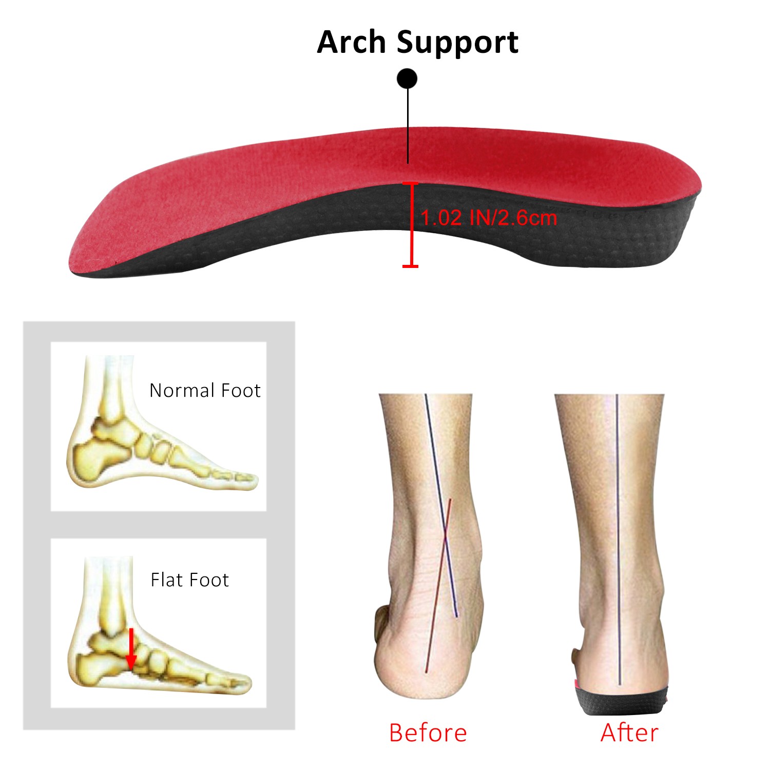 Orthotic Shoe Insoles Inserts Flat Feet High Arch Support Plantar Fasciitis