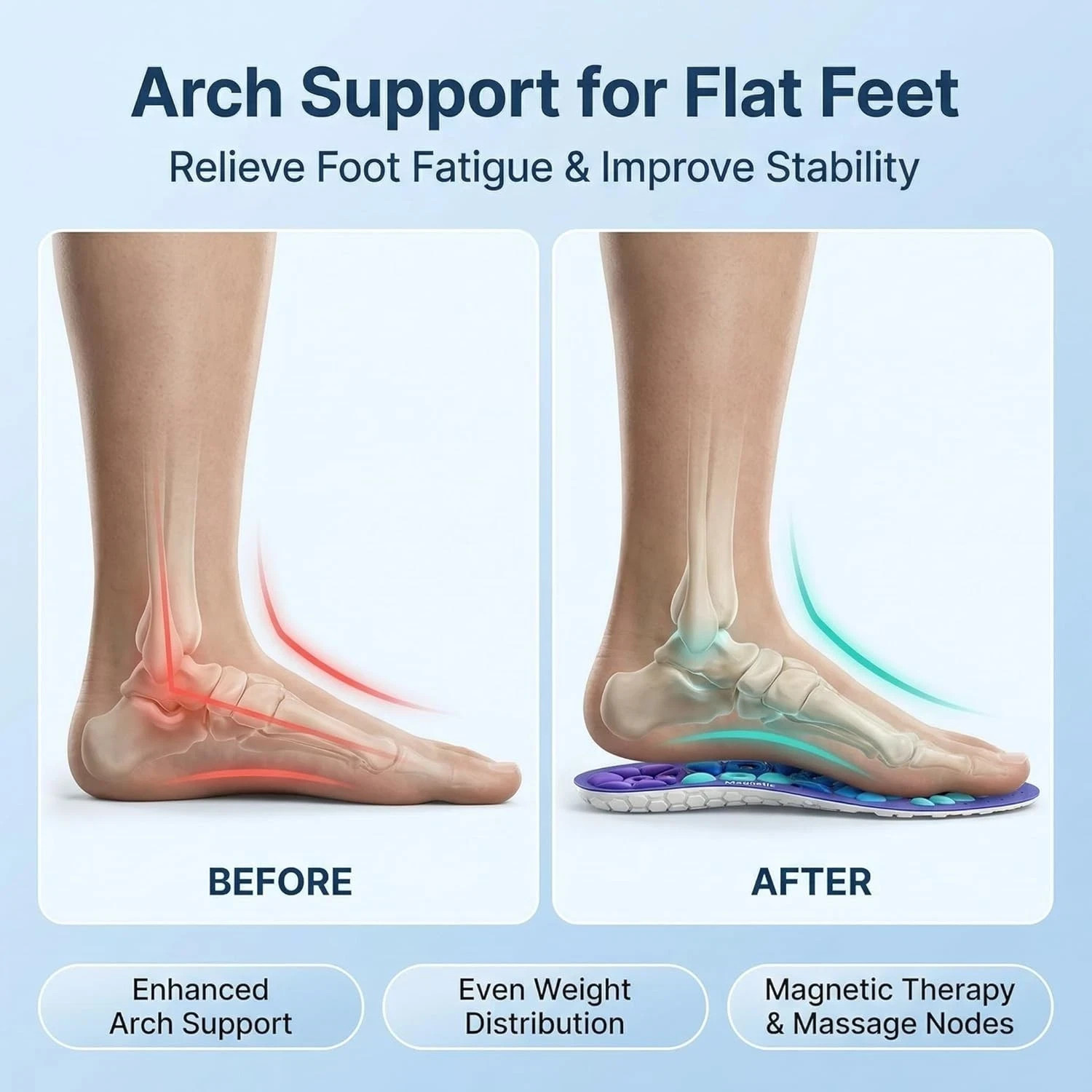 AKUSOLI Shoe Insoles for Men & Women. Shoe Insoles Arch Support for Pain Relief