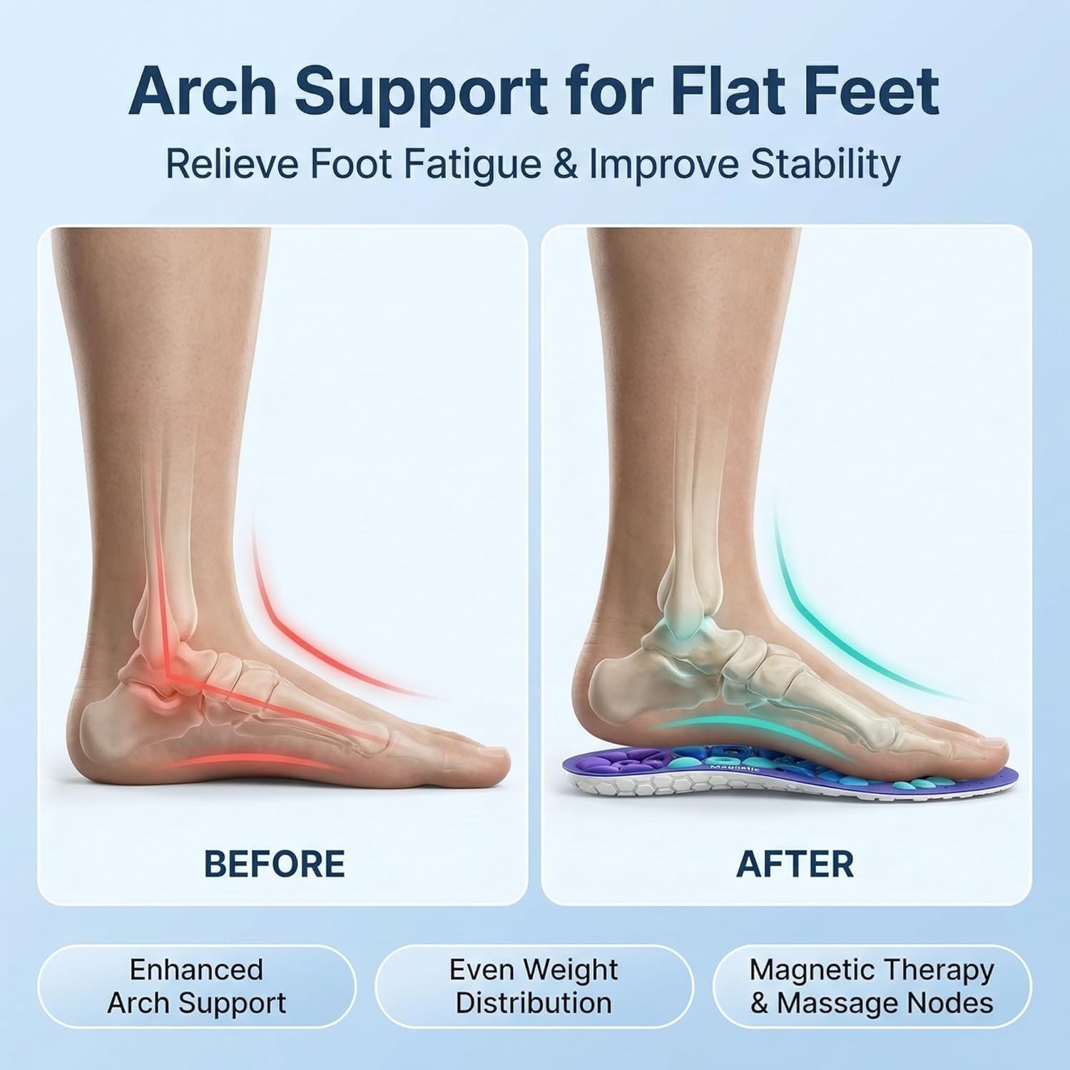 Shoe Insoles for Men & Women. Shoe Insoles Arch Support for Pain Relief